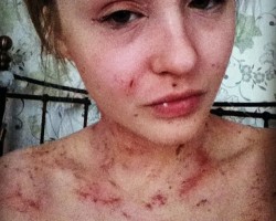 На фото Эми-Луиза Джеймс