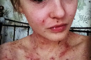 Эми-Луиза Джеймс
